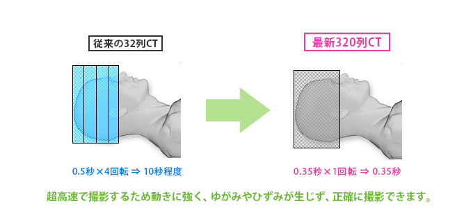 16cmの広範囲を一瞬で高精細撮影